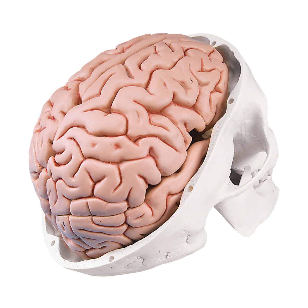 Человеческий мозг. Мозг в черепной коробке.
